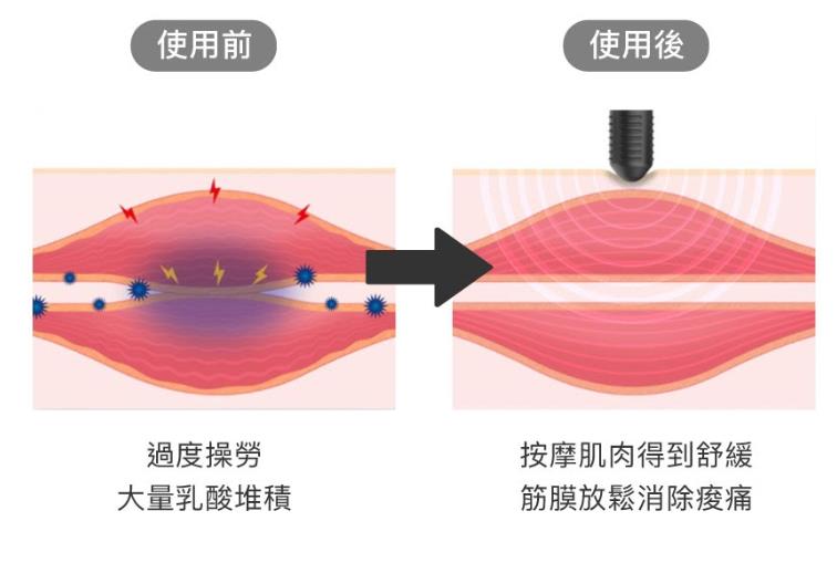 使用筋膜按摩枪前后的对照图